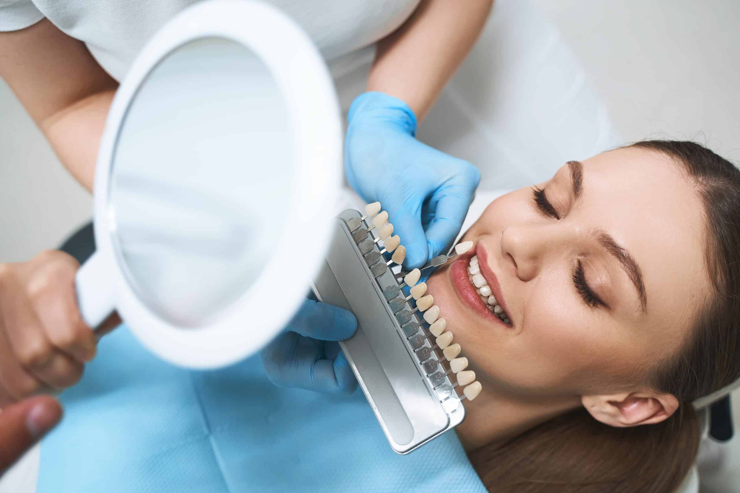 nampa dental veneers