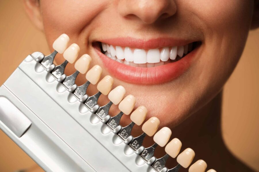 dental veneers nampa id